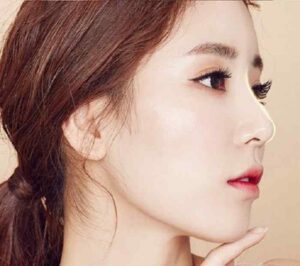 nâng mũi/sửa mũi ở Hạ Long