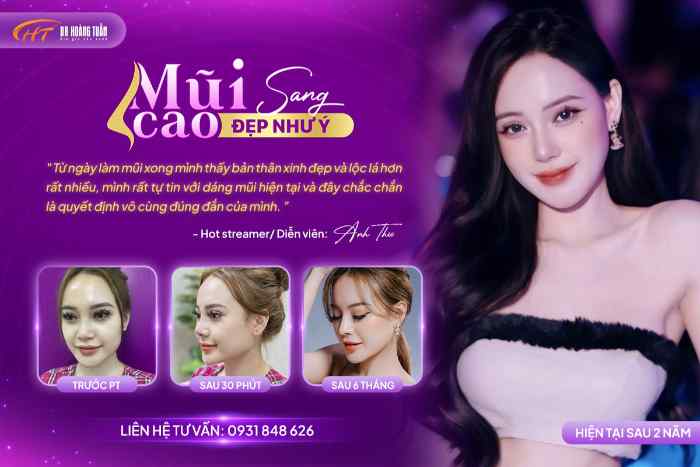 Top 4 địa chỉ nâng mũi/sửa mũi ở Hạ Long uy tín 2 Thẩm mỹ Hoàng Tuấn - nâng mũi/sửa mũi ở Hạ Long