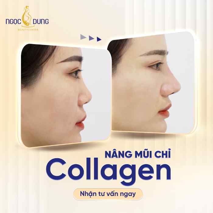 Top 4 địa chỉ nâng mũi/sửa mũi ở Hạ Long uy tín 4 Thẩm mỹ viện Ngọc Dung