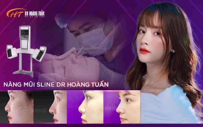 5 Địa chỉ nâng mũi/sửa mũi ở Quảng Ninh hàng đầu 2 Thẩm mỹ Hoàng Tuấn