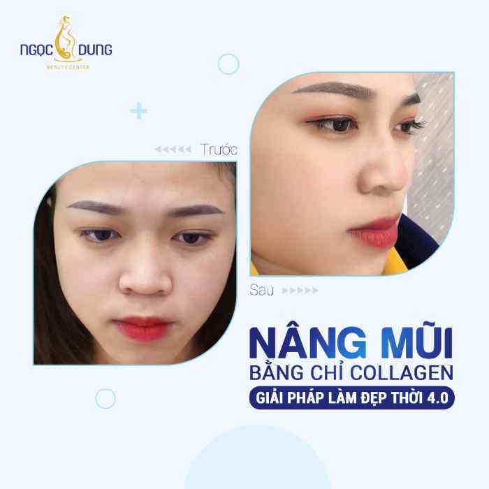 5 Địa chỉ nâng mũi/sửa mũi ở Quảng Ninh hàng đầu 4 Thẩm mỹ viện Ngọc Dung