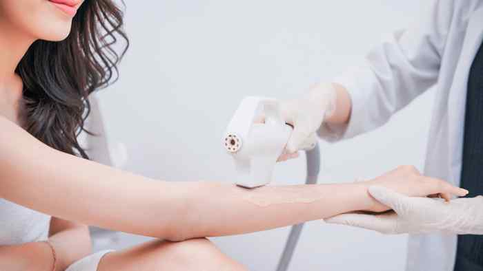 triệt lông ở Quảng Ninh